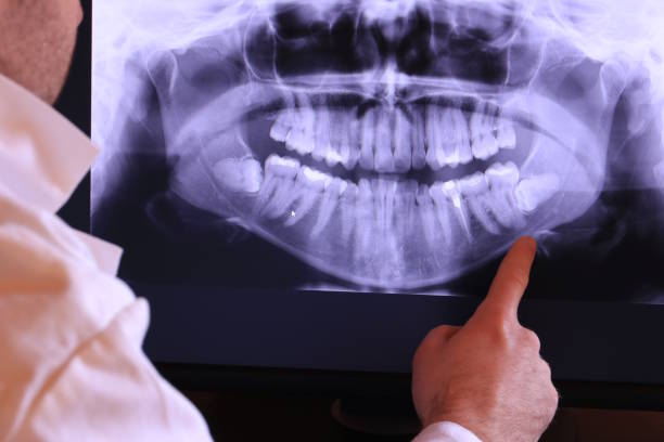 Best Dental Abscess Treatment in Vega, TX